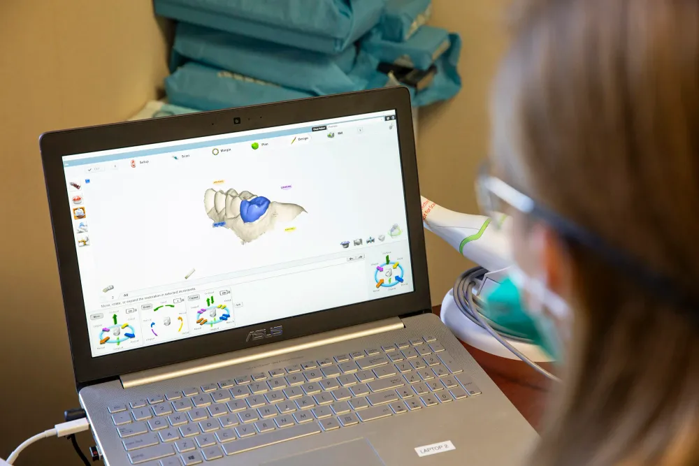 A 3D dental model on a laptop screen, with an intraoral scanner in the background.